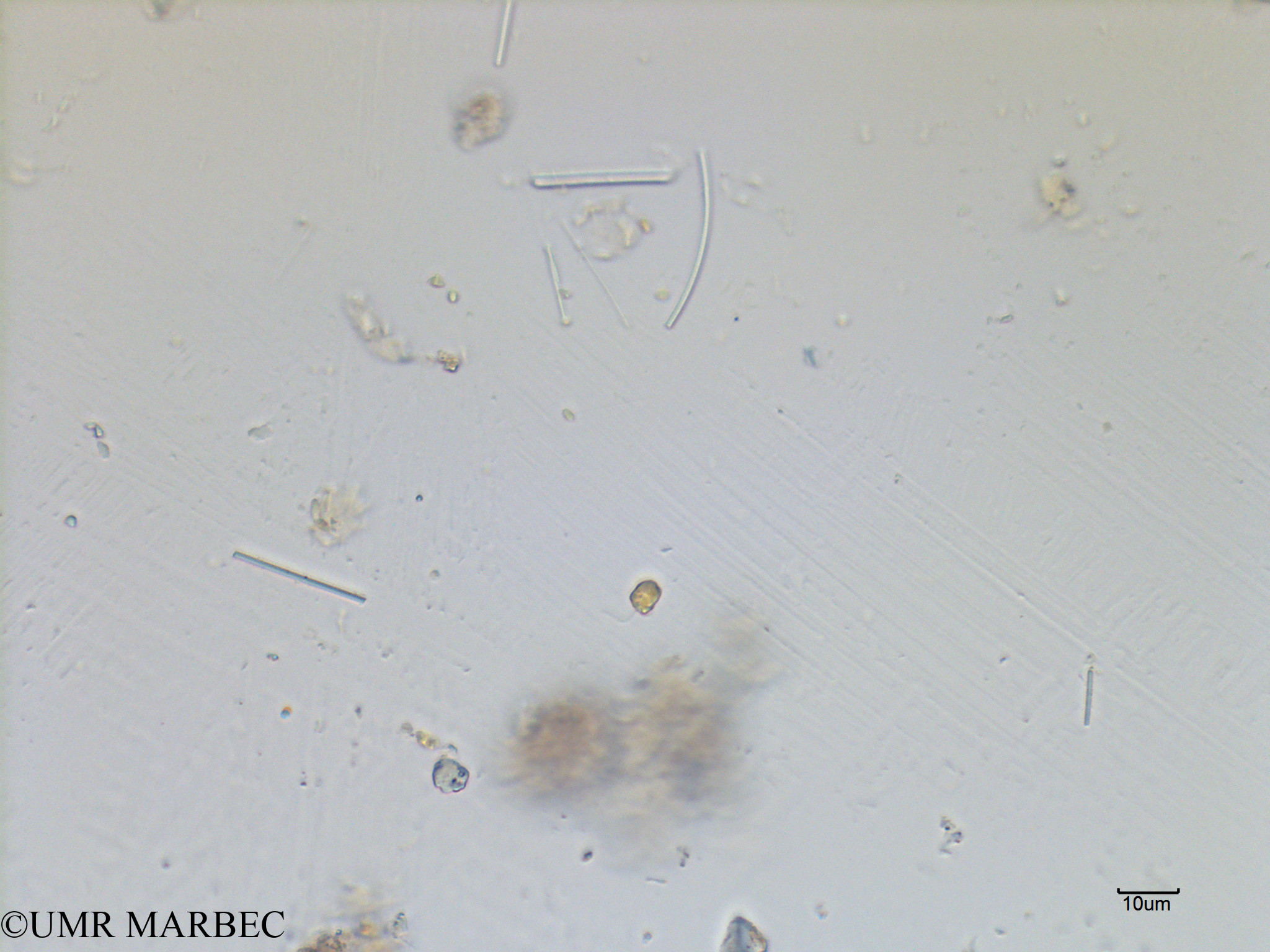phyto/Scattered_Islands/mayotte_lagoon/SIREME May 2016/Nanoflagellé 9 (MAY8_microflagelle 8-2).tif(copy).jpg